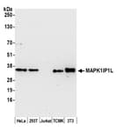 Detection of human and mouse MAPK1IP1L by western blot.