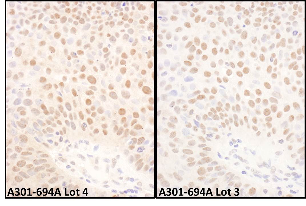 Detection of human BMI1 by immunohistochemistry.
