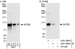 Detection of human SATB2 by western blot and immunoprecipitation.