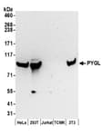 Detection of human and mouse PYGL by western blot.