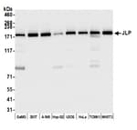 Detection of human and mouse JLP by western blot.