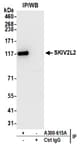 Detection of human SKIV2L2 by western blot of immunoprecipitates.