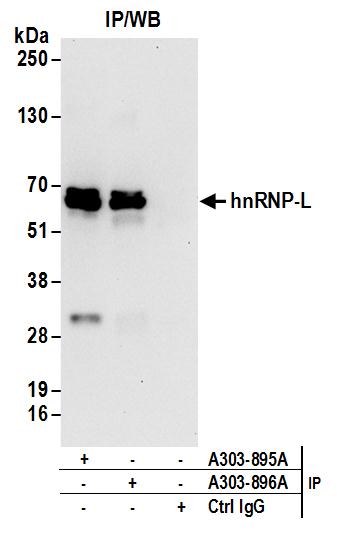 Detection of human hnRNP-L by western blot of immunoprecipitates.