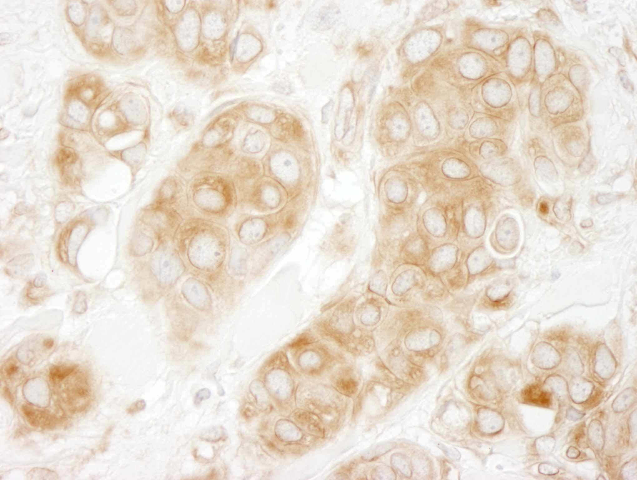 Rabbit anti-GIT1 IHC Antibody
