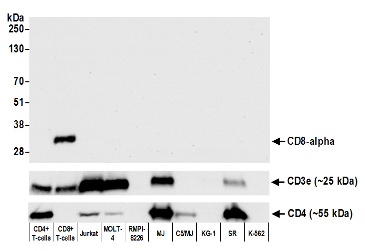 Rabbit anti-CD8 alpha Recombinant Monoclonal Antibody [BLR044F]