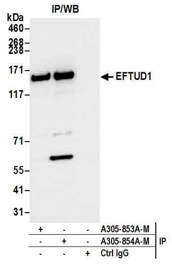 Detection of human EFTUD1 by western blot of immunoprecipitates.