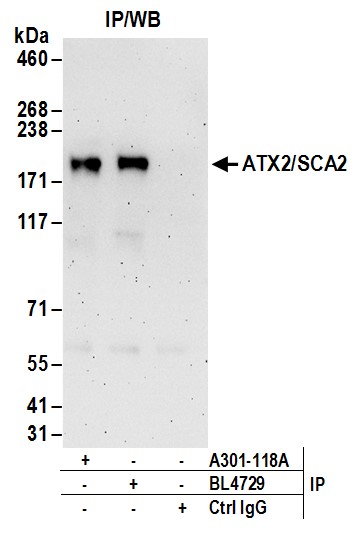Detection of human ATX2/SCA2 by western blot of immunoprecipitates.