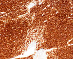 Detection of human CD45 by immunohistochemistry.