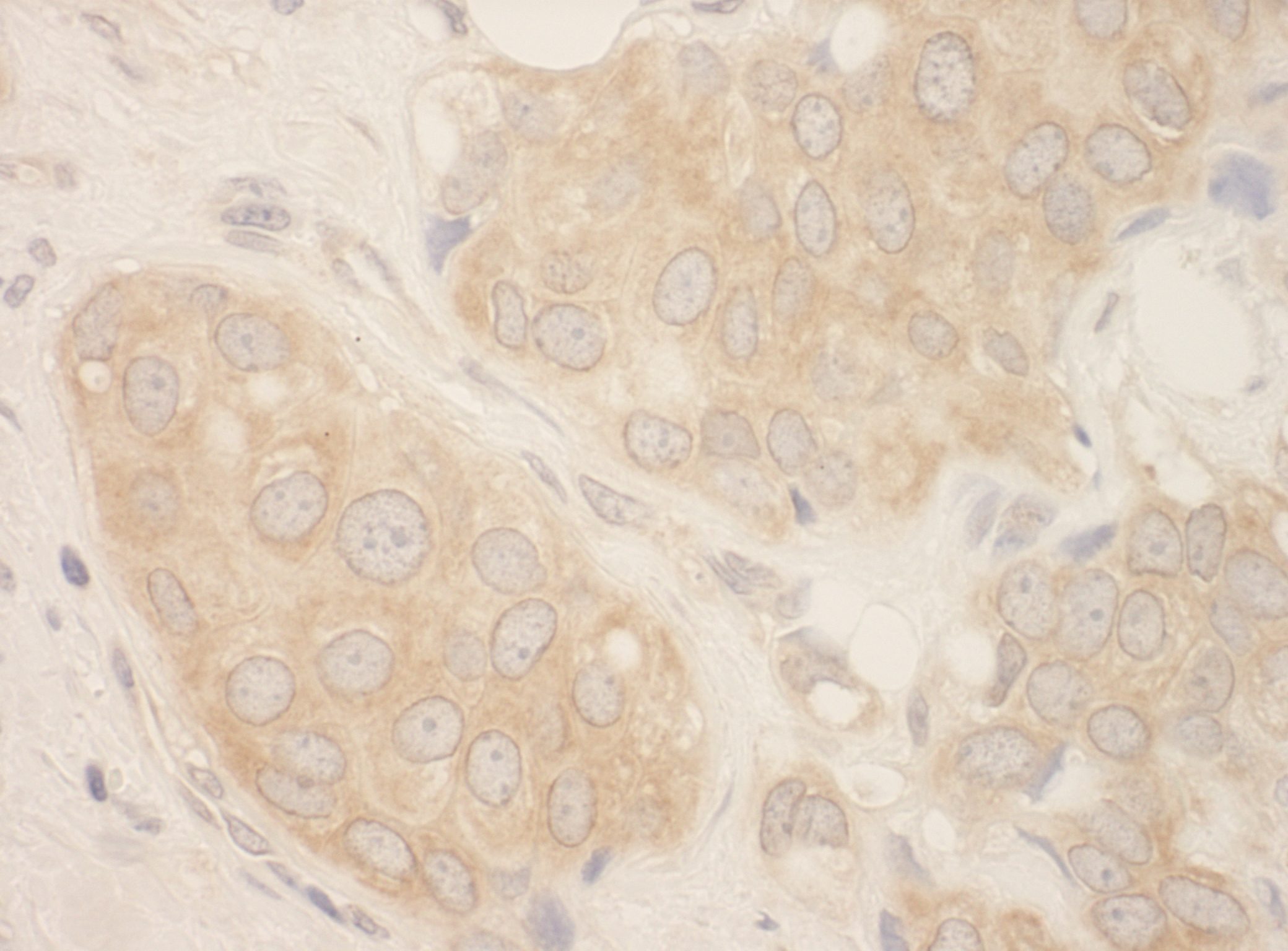 Rabbit anti-SRPK2 IHC Antibody
