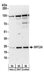 Detection of human SPC24 by western blot.