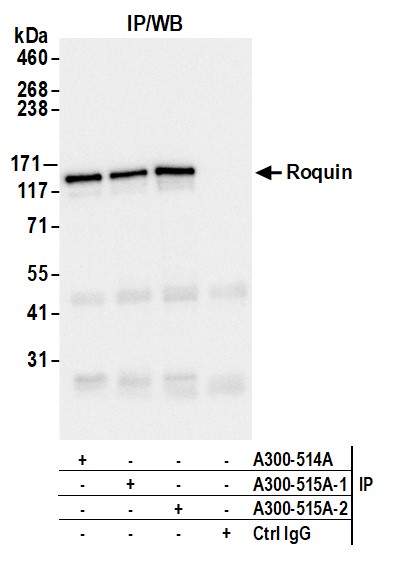 Detection of human Roquin by western blot of immunoprecipitates.