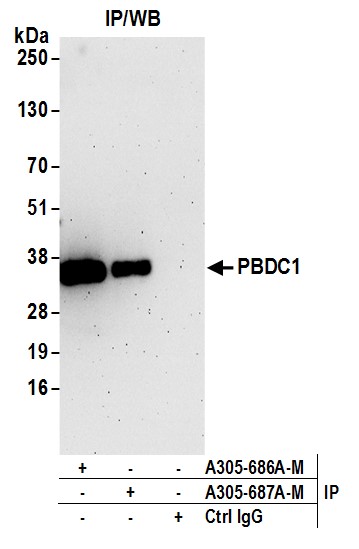 Detection of human PBDC1 by western blot of immunoprecipitates.