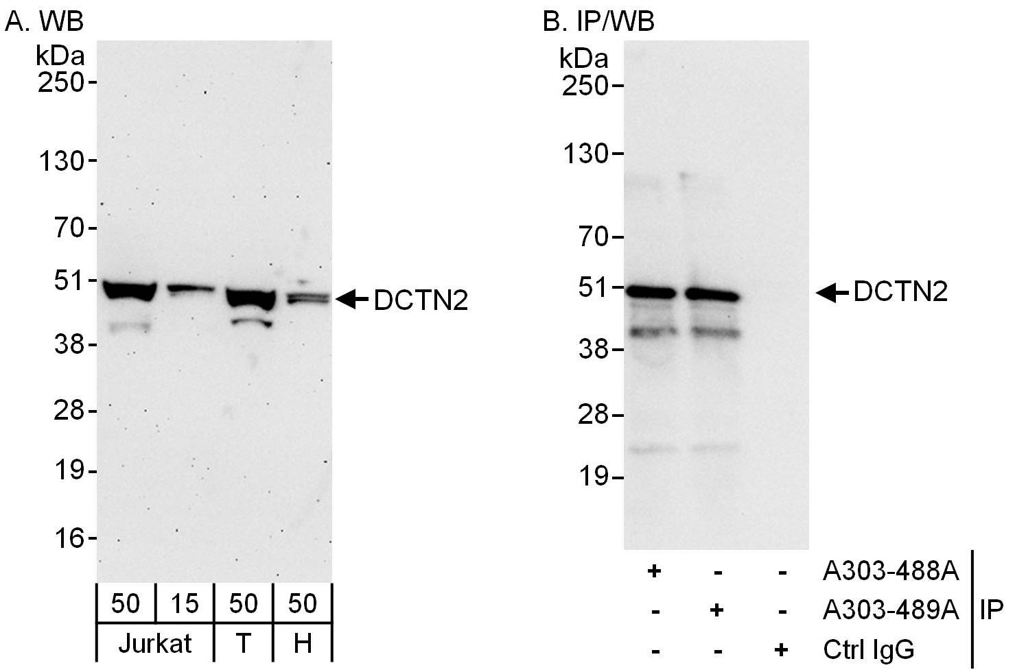 Detection of human DCTN2 by western blot and immunoprecipitation.