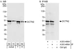 Detection of human DCTN2 by western blot and immunoprecipitation.