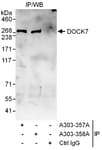 Detection of human DOCK7 by western blot of immunoprecipitates.