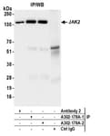 Detection of human JAK2 by western blot of immunoprecipitates.