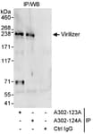 Detection of human Virilizer by western blot of immunoprecipitates.