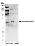 Detection of human Junctophilin-2 by western blot.