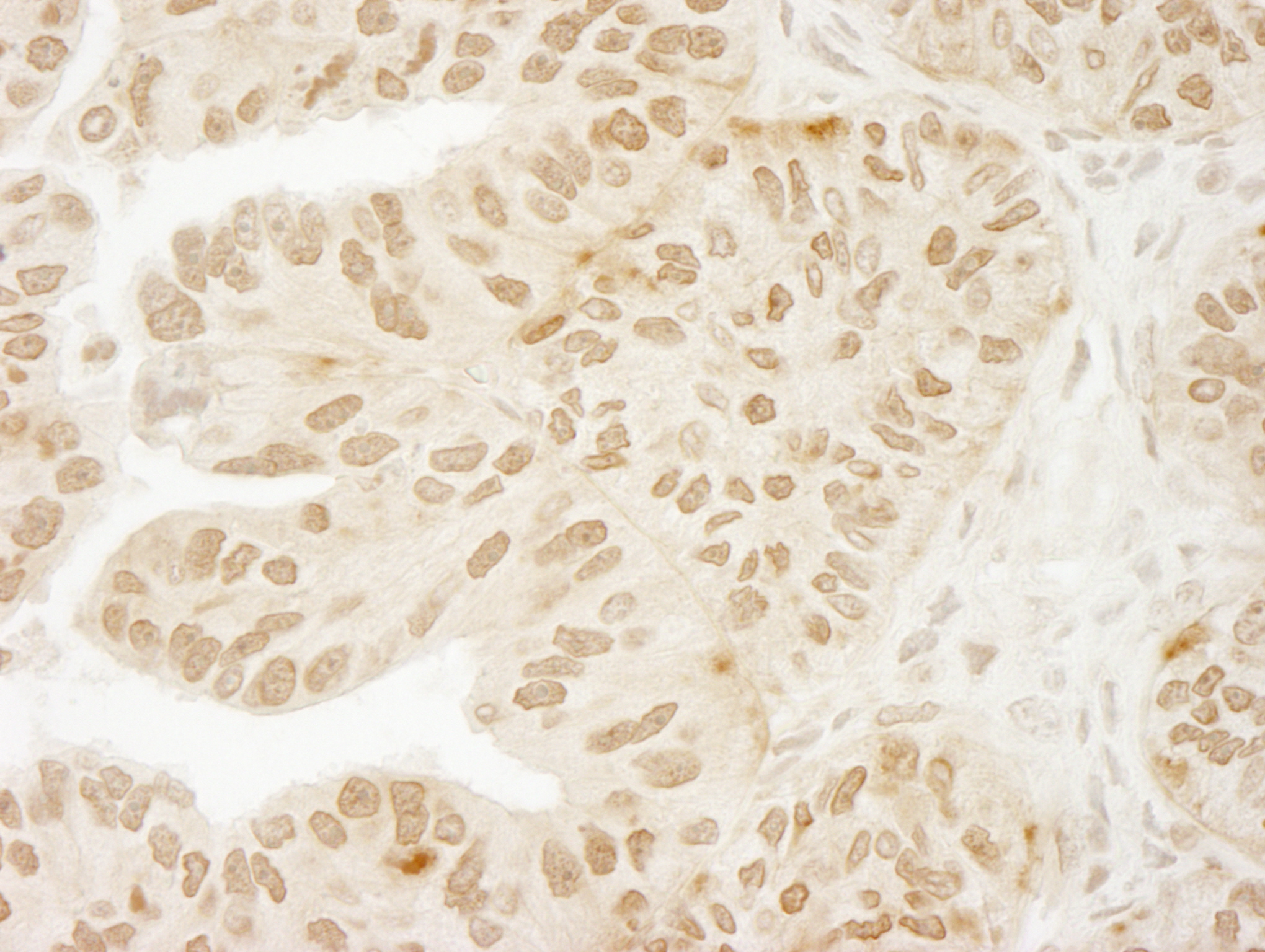 Rabbit anti-USP15 IHC Antibody