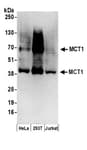 Detection of human MCT1 by western blot.