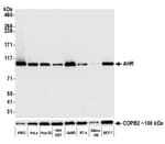Detection of human AHR by western blot.