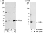 Detection of human HMG2a by western blot and immunoprecipitation.