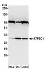 Detection of human ATP5C1 by western blot.
