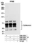 Detection of human Caldesmon by western blot of immunoprecipitates.