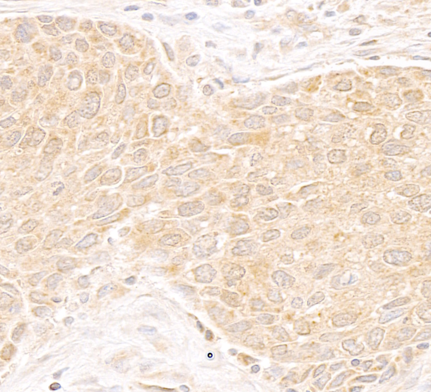 Detection of human DDX19 by immunohistochemistry.