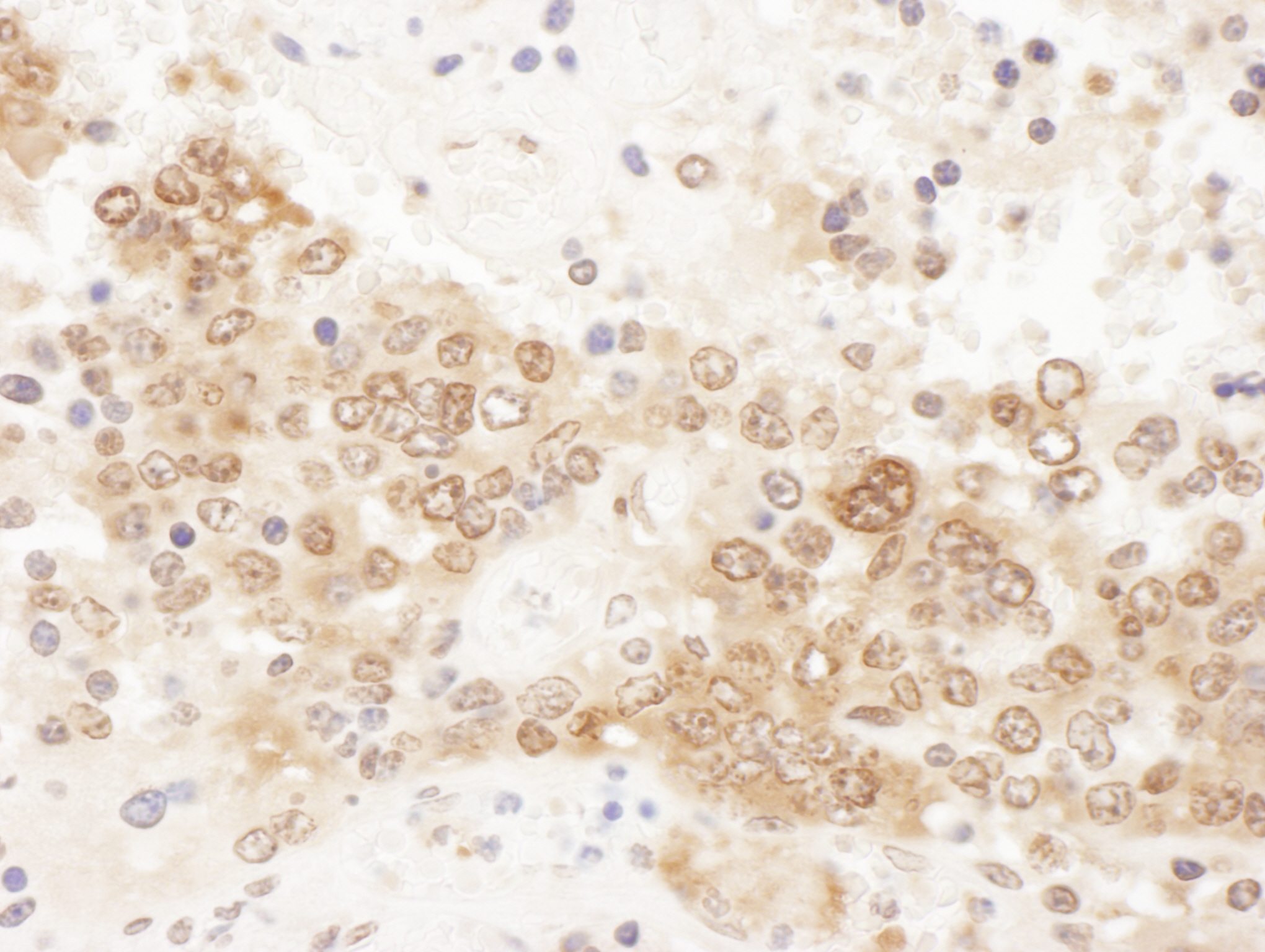 Detection of mouse ICLN by immunohistochemistry.