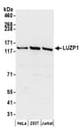 Detection of human LUZP1 by western blot.
