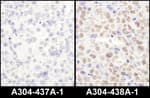 Detection of mouse LAS1L by immunohistochemistry.