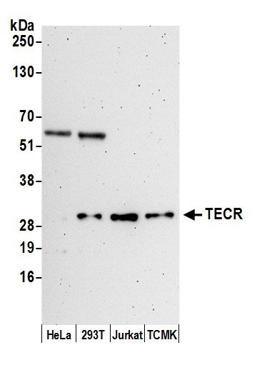 Detection of human and mouse TECR by western blot.
