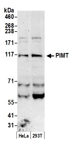 Detection of human PIMT by western blot.