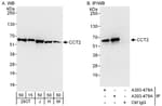 Detection of human and mouse CCT2 by western blot (h and m) and immunoprecipitation (h).