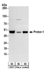Detection of human Protor-1 by western blot.