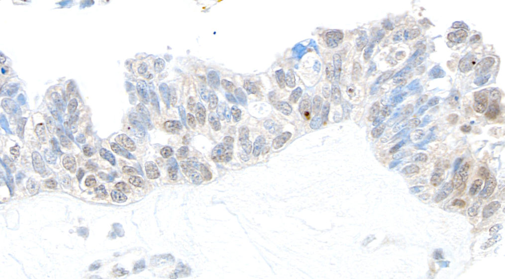 Detection of human USP10 by immunohistochemistry.