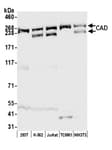 Detection of human and mouse CAD by western blot.