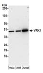 Detection of human VRK1 by western blot.