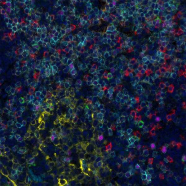 Detection of human CD3 (cyan), CD4 (orange), CD8 (red), cytokeratin (yellow), FOXP3 (magenta), and LAG3 (green) in FFPE tonsil by IHC-IF. 
