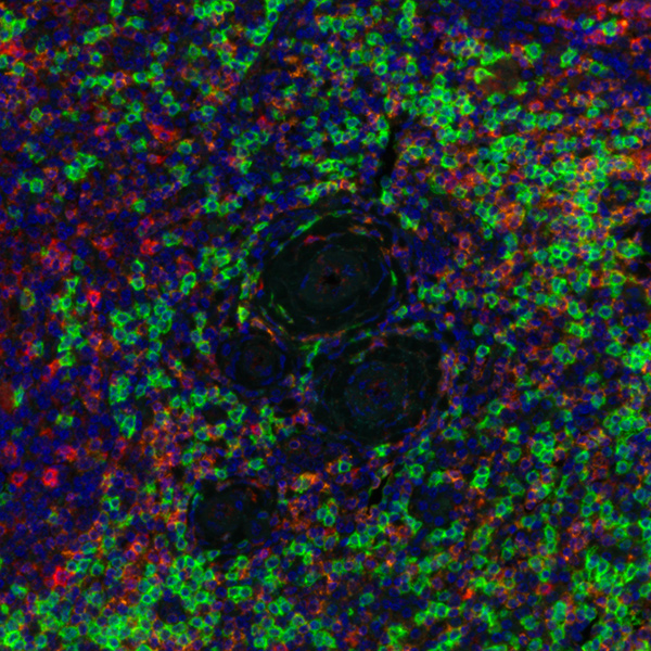 Detection of human CD8 (green), CD4 (orange), TIGIT (red), and FOXP3 (cyan) in tonsil by IHC-IF.