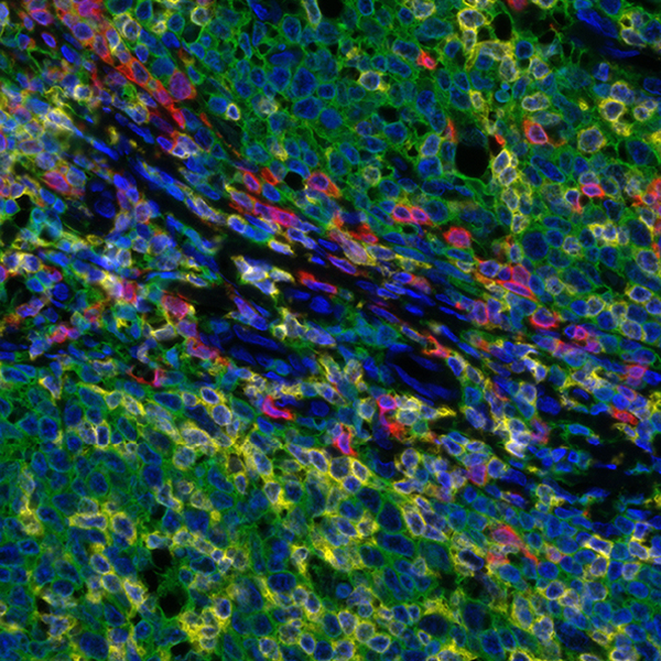 Detection of human CD3 (yellow), CD8 (red), and CD20 (green) in FFPE tonsil by IHC-IF.