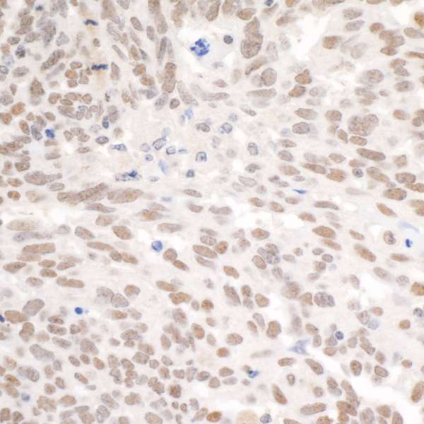 Detection of human PBRM1 by immunohistochemistry.