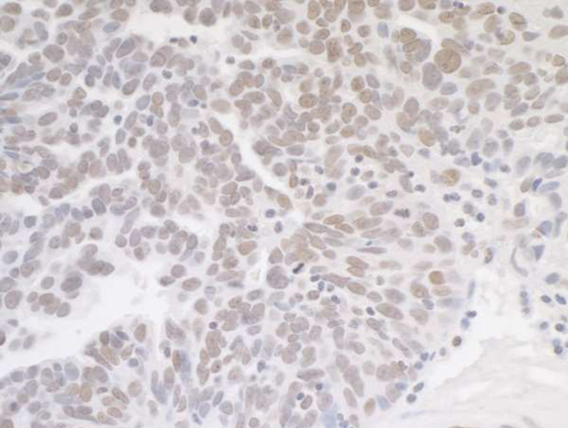Detection of human MED12 by immunohistochemistry.