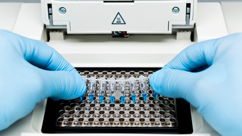 Scientist Extracting a Rack Tube With Urine Samples. Closeup of a Scientist Working With Urine Samples in Lab.