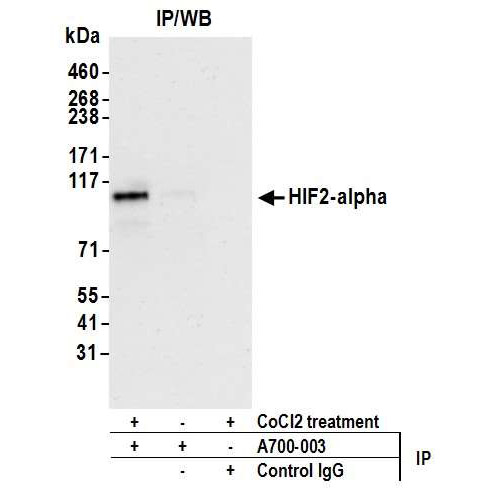 Detection of human HIF2-alpha by WB of immunoprecipitates from HEPG2 lysate treated with 200 µM CoCl2 (+) or mock treated (-).