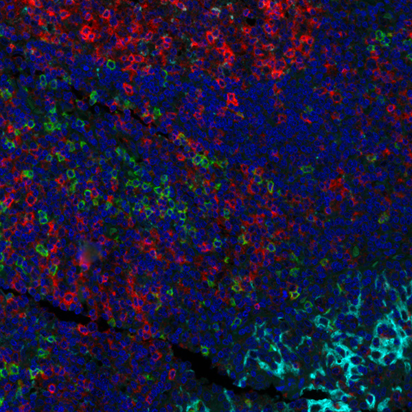 Detection of human CD8 (green) TIGIT (red) and PD-L1 (cyan) in tonsil by IHC-IF.