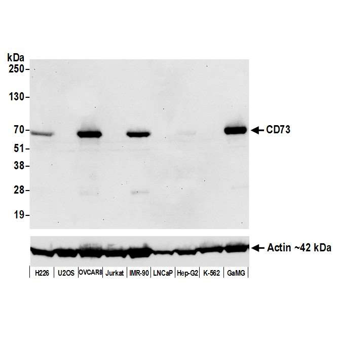 Detection of human CD73 by WB of H226, U2OS, OVCAR-8, Jurkat, IMR-90, LNCaP, Hep-G2, K-562, and GaMG lysate.