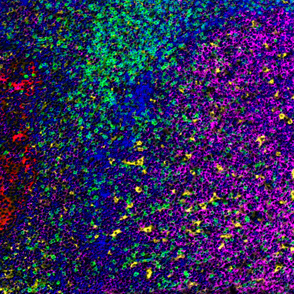 Detection of human CD3 (green), CD20 (magenta), CD68 (yellow), and cytokeratin (red) in FFPE tonsil by IHC-IF.