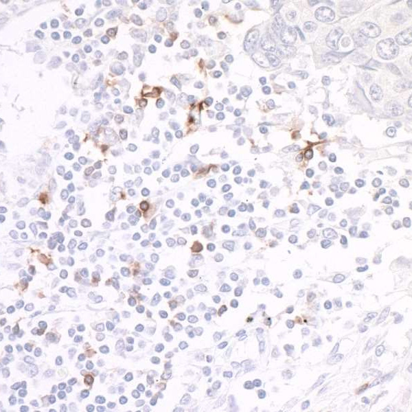 Detection of human OX40/CD134 by immunohistochemistry.